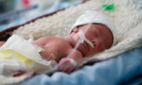 В Україні збільшується кількість недоношених дітей