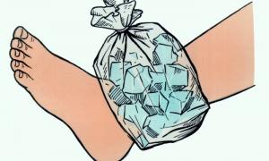 Прикладати «холод» до травми шкідливо