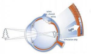 Створено імплантат, який дозволить бачити сліпим людям