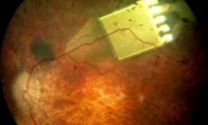 Винайдено потужний імплантат, який дозволить читати сліпим