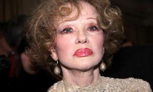 Людмила Гурченко перебуває в реанімації після операції