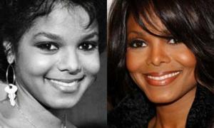 Лікарі радять Джанет Джексон відмовитись від пластичних операцій	