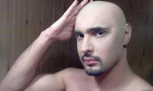 Віталій Козловський поповнив лави лисих чоловіків-зірок