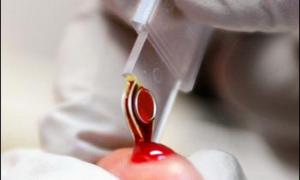 «Біологічний вік» людини можна визначити за аналізом крові	