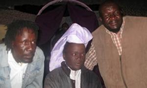 30-річний найпотворніший зімбабвієць радий своєму успіху