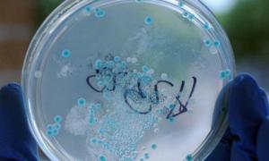 Небезпечна кишкова інфекція дісталася до Польщі