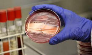 Кишковий вірус потрапив до Європи з Єгипту