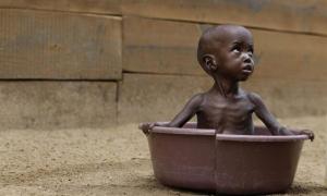 У Східній Африці від голоду страждають понад 12 мільйонів людей