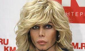 Стиліст Сергій Звєрєв зламав плече