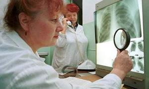 Україна – сьома в Європі за рівнем захворюваності на туберкульоз 