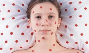 У селі Підгайці закрили школу через загрозу поширення кору