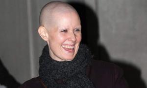 Міранда із «Сексу у великому місті» стала лисою