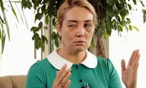 Розинська вважає, що її побили через Мельниченка