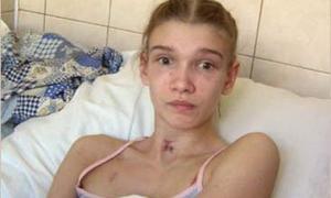 Через кілька днів Сашу Попову випишуть з лікарні