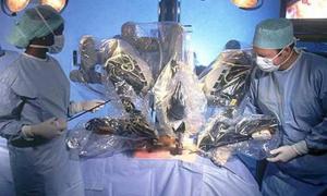 Робот-хірург успішно впорався з операцією на відкритому серці