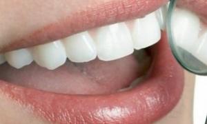 Відбілювання зубів негативно впливає на зір