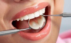 Чутливі зуби вилікують мідії