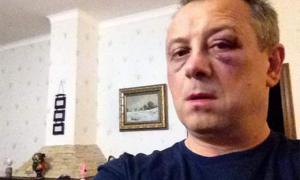 Депутата від «УДАРу» побили невідомі