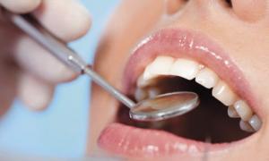 Клінічне відбілювання зубів зробить їх світлішими на шість-вісім тонів