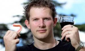 Чоловік втратив усі зуби через любов до газованої води