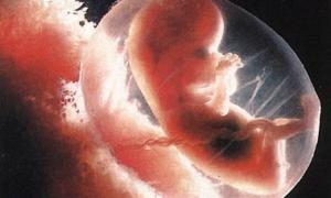 Вчені вперше виростили ембріон людини в лабораторії