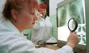 У МОЗ заявили, що в Україні немає епідемії туберкульозу