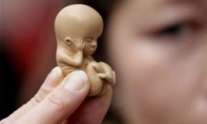 Палата представників США проголосувала за обмеження абортів