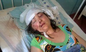 У справі про зґвалтування у Врадіївці дають свідчення таксист і жертва насильників