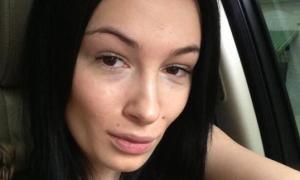 Настя Приходько зробила пластику щелепи