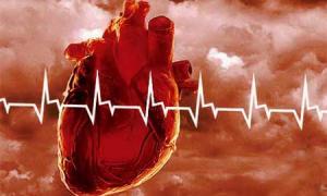 В Україні зафіксовано 65% смертей від хвороб серця