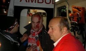Побиті на майдані поляки розповіли, як усе було 