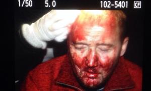 Під час штурму АП постаждали журналісти