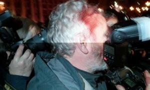 «Беркут» по-звірячому бив журналістів, які висвітлювали події на вулиці (списки потерпілих)
