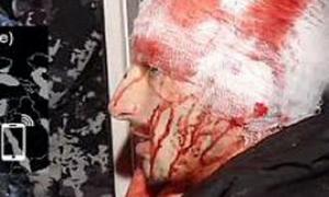 У Рівному буде "Алея побитих журналістів"