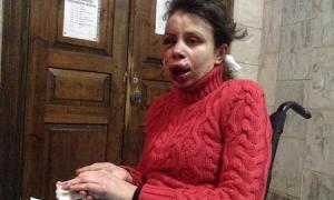 Міліція відкрила провадження за фактом нападу на Тетяну Чорновол