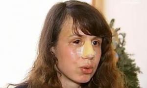 Тетяна Чорновол дала перше інтерв’ю після побиття