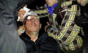 Лікарі наполягають, що Луценко був п’яним під час інциденту з «Беркутом»