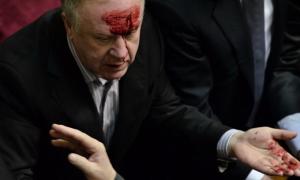 Регіоналу розбили голову під час засідання парламенту