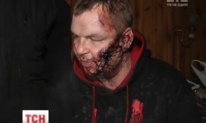Дмитра Булатова катували всі 8 днів, доки автомайданівці його шукали
