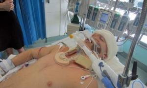 Шумахер добре реагує на виведення зі штучної коми