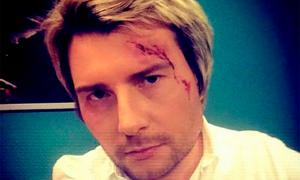 Басков розбив голову на весіллі доньки Крутого