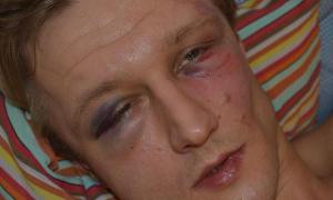 Невідомі з криками «сепаратист» побили викладача Могилянки