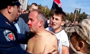 У побитого Шуфрича діагностували черепно-мозкову травму