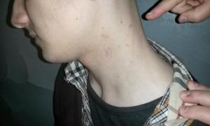 Міліція побила неповнолітнього, який влаштував акцію проти бізнесу Порошенка