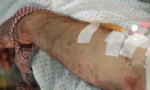 Доба в зоні АТО обійшлася без жертв, шестеро бійців отримали поранення