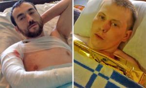 Два різні світи українського затримання і полону бойовиків