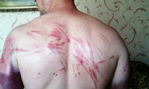 Священик Сергій Косяк розповів, як над ним знущались бойовики