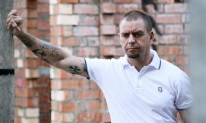 Сергій Міхалок порівняв політику Путіна з «запаленим апендицитом»