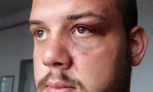 Вірність «ментівським» методам: затриманого торнадівця відпустили зі страшними побоями