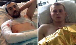 Російське Міноборони офіційно відмовилося від ГРУшників, затриманих під Щастям 